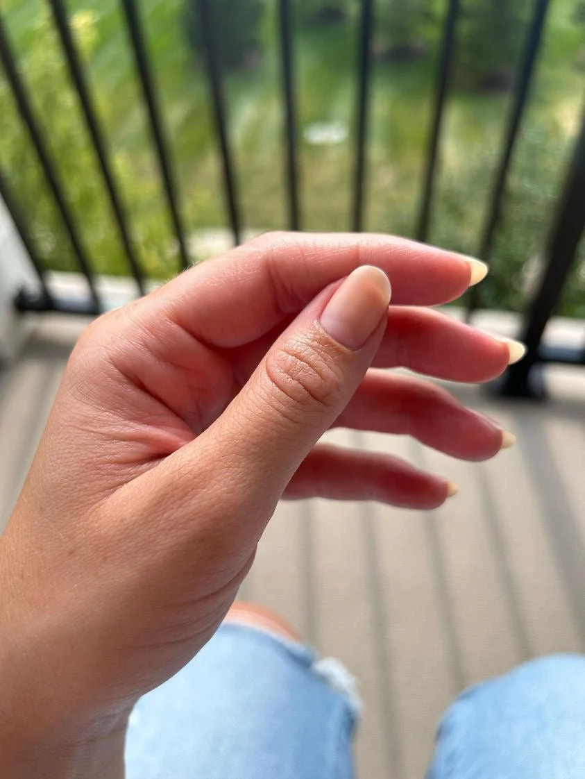 Thumb 3